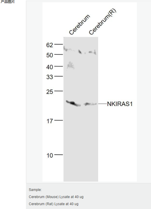 6059a500997d0.png image.png